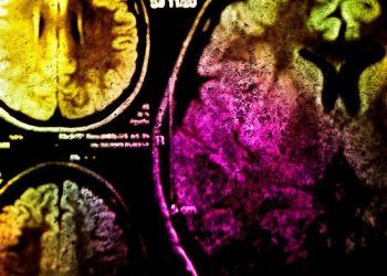 Фотоиммунотерапия поможет бороться с раком при помощи света