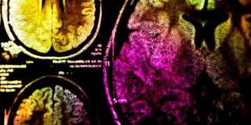 Фотоиммунотерапия поможет бороться с раком при помощи света