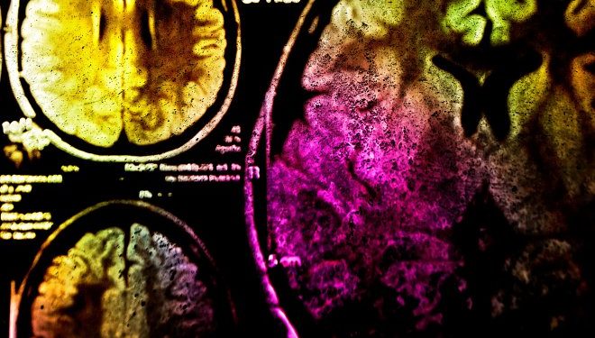 Фотоиммунотерапия поможет бороться с раком при помощи света