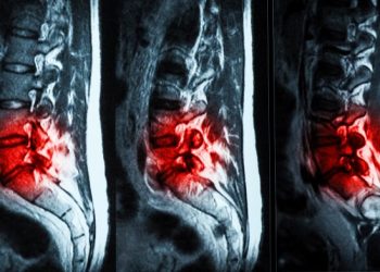 Инъекционный гидрогель эффективно избавит от болей в пояснице