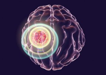 Инфракрасный имплант в черепе показал эффективность в борьбе с раком мозга