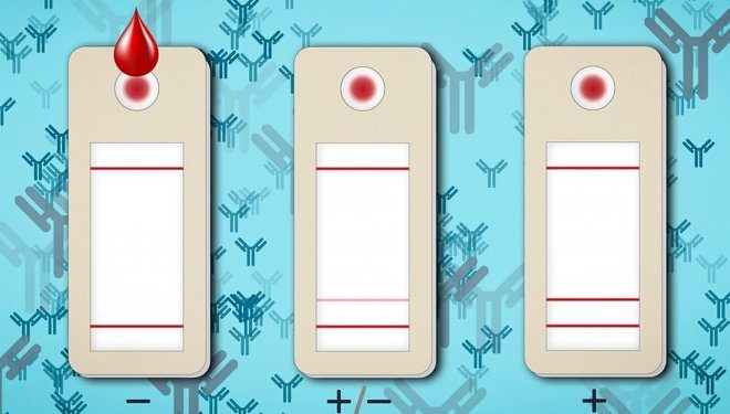 В MIT разработали очень простой и быстрый тест на иммунитет к COVID-19