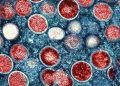 ВОЗ объявила вспышку обезьяньей оспы чрезвычайной ситуацией мирового значения
