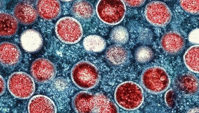 ВОЗ объявила вспышку обезьяньей оспы чрезвычайной ситуацией мирового значения