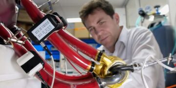 Человек впервые в мире прожил 100 дней с титановым сердцем и выписался из больницы