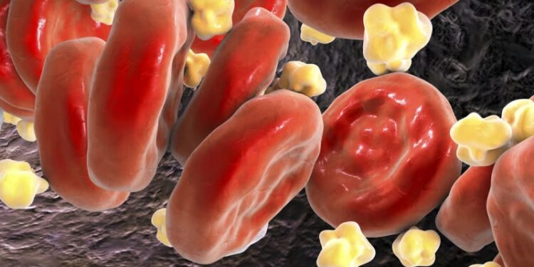 Комбинация двух препаратов снижает уровень холестерина в крови на 49 %