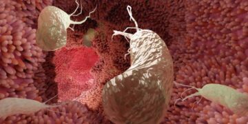 75% случаев рака желудка можно предотвратить с помощью простой профилактической меры