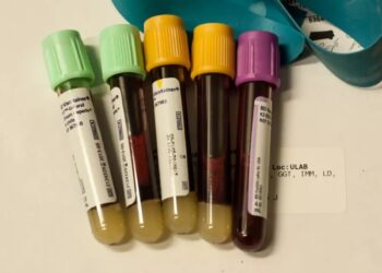 В Стэнфорде разработали анализ крови для определения скорости старения отдельных органов