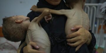 Каждый третий ребенок в Газе голодает, заявил комиссар ООН