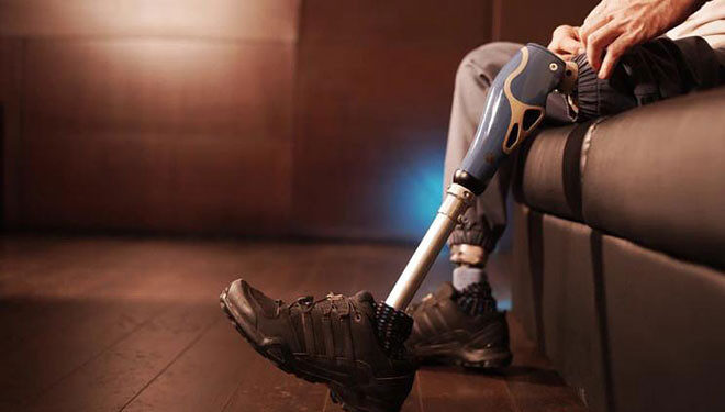 В России впервые провели имплантацию модульного эндопротеза