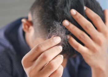 Натуральный подсластитель оказался необычайно полезным в борьбе с мужским облысением