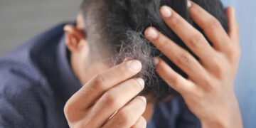 Натуральный подсластитель оказался необычайно полезным в борьбе с мужским облысением