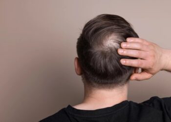 В США завершаются испытания первой эффективной таблетки от облысения