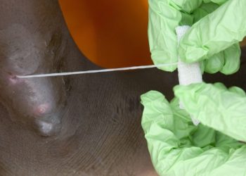 Человечество в шаге от полной победы над второй (после оспы) инфекционной болезнью в истории